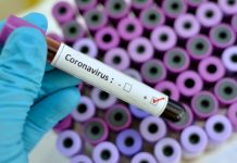 Covid-19 au Togo : Deux nouveaux décès enregistrés ce jeudi.