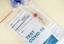 Covid-19/Togo : voici combien coûte désormais le test PCR !