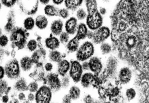 Togo : vigilance, des cas du virus Lassa confirmés dans la sous-région