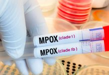 Mpox à Lomé : huit cas confirmés, une riposte discrète mais déterminée