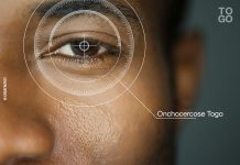Onchocercose : le Togo proche du triomphe