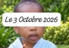 Opération chirurgicale : EBOMAF redonne le sourire à une fillette